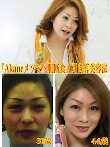 『Akaneメソッド 肌断食』引き算美容法 『Akaneメソッド 肌断食』引き算美容法